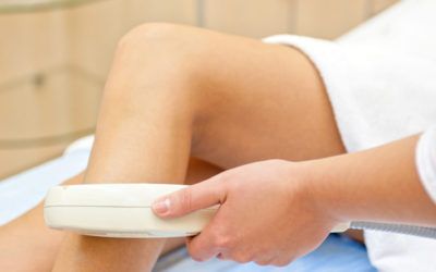 Tienes vitíligo…. ¡olvídate de la depilación láser!