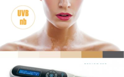 Invierno… Tiempo de fototerapia para el tratamiento del vitíligo