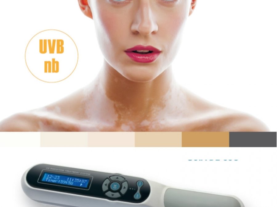Tratamiento del vitiligo con fototerapia en invierno