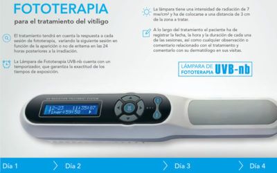 Fototerapia, la mejor opción para tratar el vitíligo cuando falta el sol